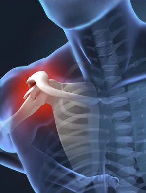 Shoulder Pain | NYC | Manhattan | Dr. Winnick | Shoulder Injury