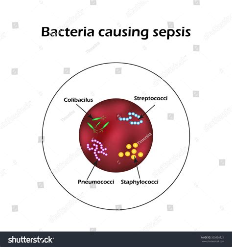 Sepsis Blood Poisoning E Coli Streptococci Stock Vector (Royalty Free