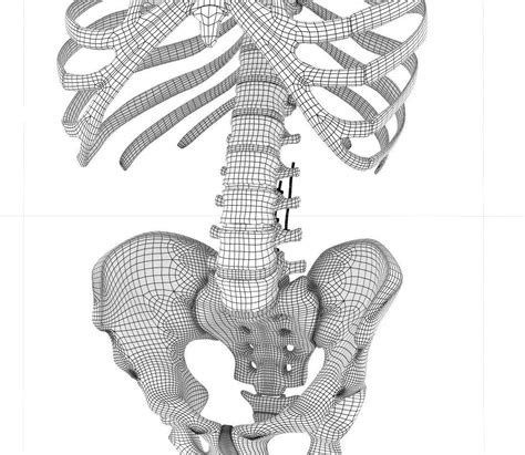 Spinal Fixation System Titanium Bracket 3d Model Cgtrader