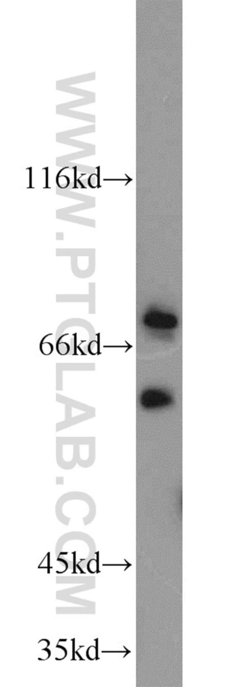 Acsl Rabbit Anti Human Mouse Rat Polyclonal Proteintech L