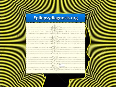 Clinical Pharmacology Of Antiseizure Drugs Ppt