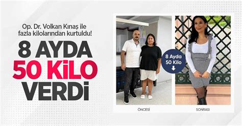 Op Dr Volkan Kınaş ile fazla kilolarından kurtuldu 8 ayda 50 kilo verdi