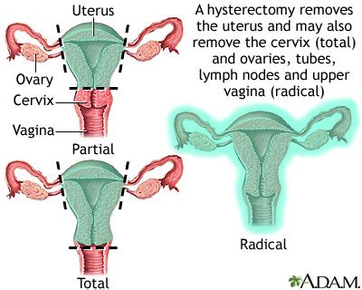 Female Reproductive Disorders Flashcards Quizlet