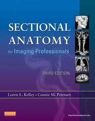 Sectional Anatomy For Imaging Professionals Ed Elsevier Elibrary