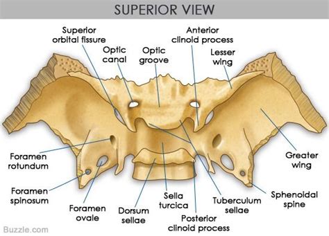 Superior Orbital Fissure Sphenoid