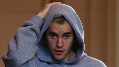 Justin Bieber Posts Emotional Message About Use Of ‘heavy Drugs