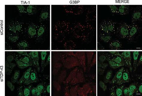 G3BP SG Formation Is Impaired By TDP 43 SiRNA Formation Of G3BP SGs