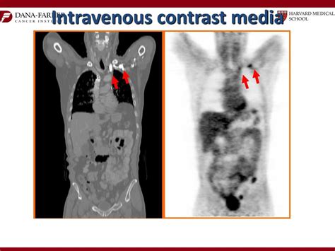 PPT Introduction To PET CT In Oncology Practical Aspects PowerPoint