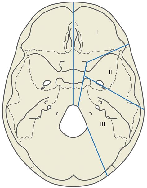 Reconstruction of the Skull Base - Clinical Tree