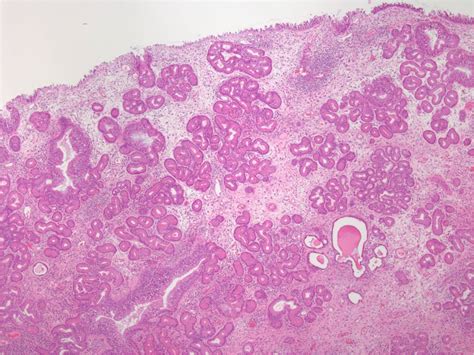 Pathology Outlines Case