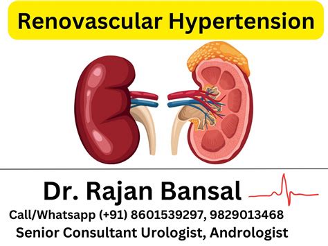 Renovascular Hypertension Causes Symptoms Diagnosis And Treatment