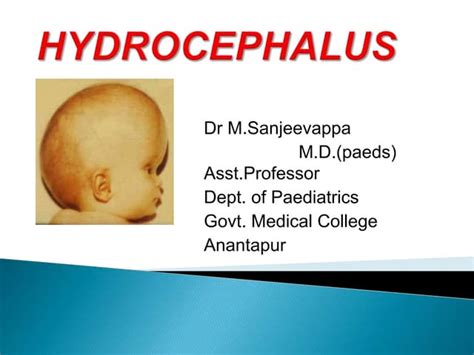 Hydrocephalus Ppt