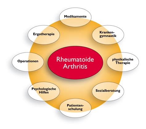 Moderne Rheumatherapie Rheuma Online