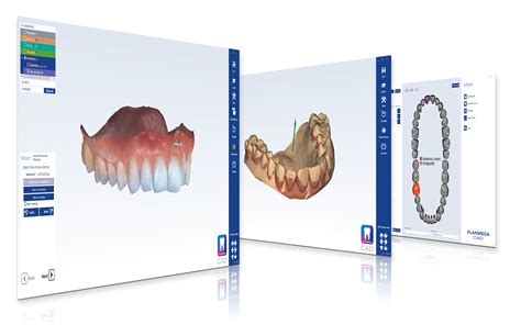 Dental Cad Cam Software What Is It And How To Choose Off