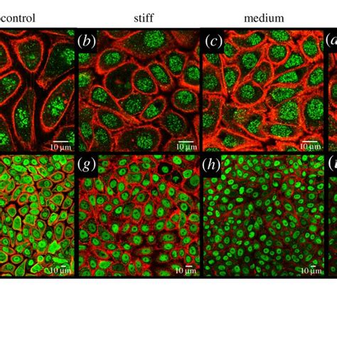 Immunocytochemical Staining For Stem Cell Markers After Days I