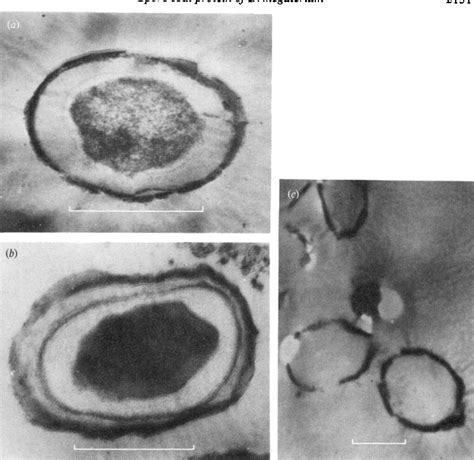 Figure From Purification And Biosynthesis Of A Spore Coat Protein In