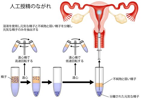 不妊治療検査 ｜ みたき総合病院 産婦人科〈三重県四日市市〉