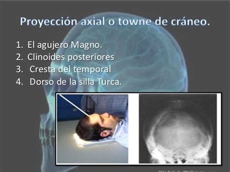 Proyecciones radiológicas del cráneo Imagenes de medicos Radiografia