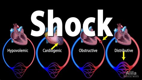 Shock And Types Of Shock