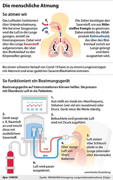 Corona Patienten Wie Funktioniert K Nstliche Beatmung