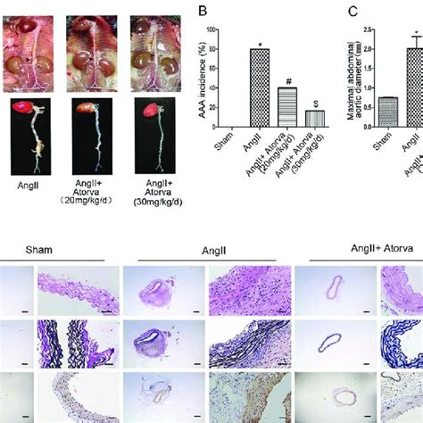 Atorvastatin Attenuates Ang II Induced AAA Formation In ApoE Mice