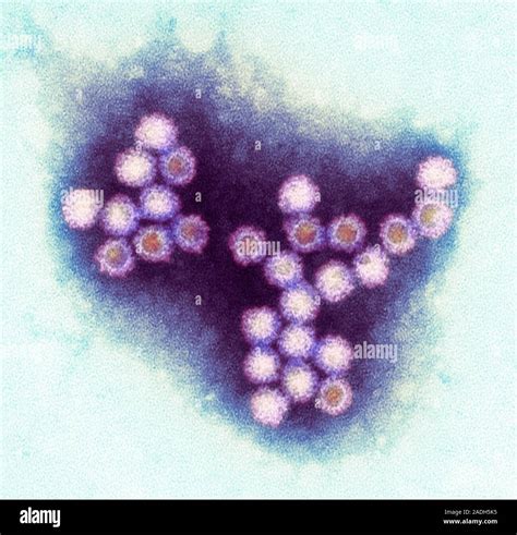 Norovirus Particles Coloured Transmission Electron Micrograph Tem Of