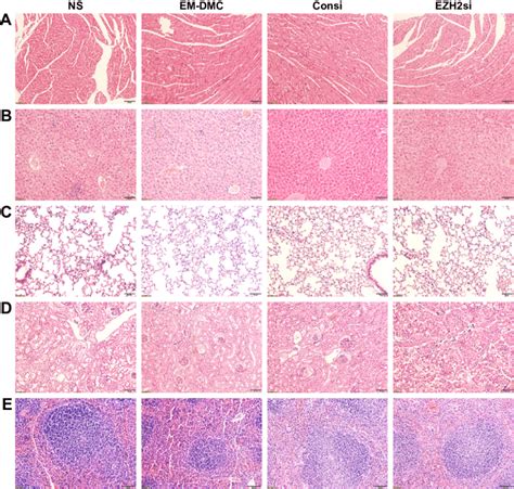 Figure S Toxicity Assessment In Vivo With Pathological Section Notes