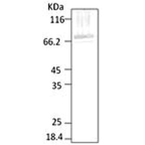 Anti PfHsp70 Antibody 11147 QED Bioscience Inc