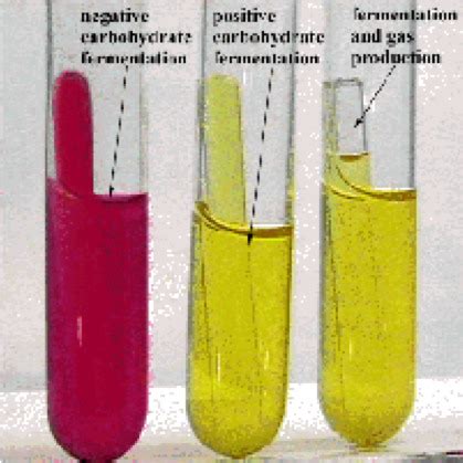 Microlab Test Flashcards Quizlet