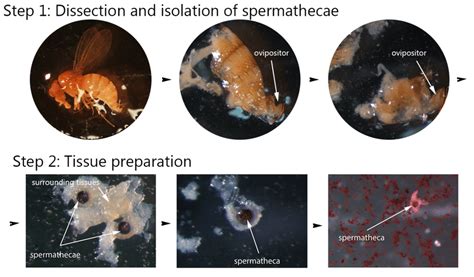 Basic Steps Of Dissecting Female Drosophila Suzukii Flies And Isolating