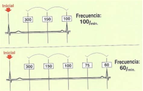 Crimen Bandera Num Rico Calculo Frecuencia Cardiaca Idea Por