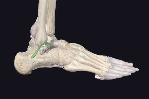 Durée de guérison d une entorse de Lisfranc combien de temps faut il