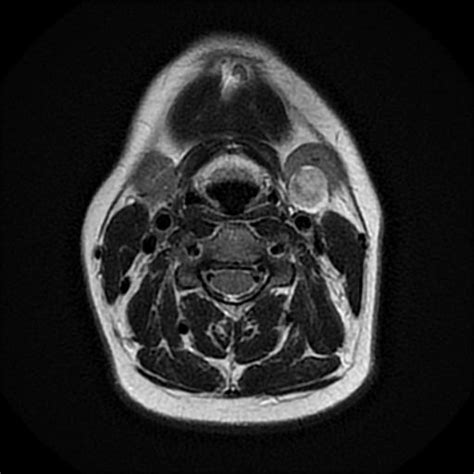 Image Radiopaedia Org