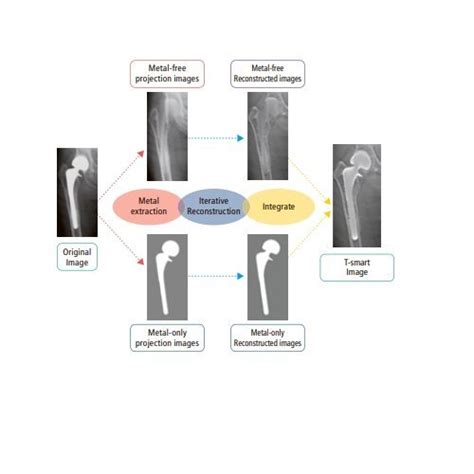 Shimadzu RADspeed Pro Style Edition EDGE Package Digital Radiography