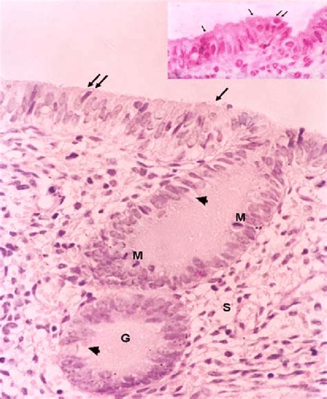 A Photomicrograph Of Higher Magnification Showing Simple Columnar