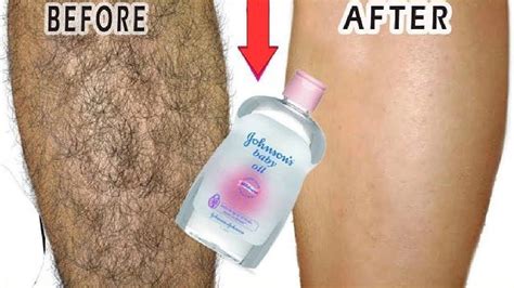 Remove Hair From Chin Permanently How To Remove Unwanted Facial Hair