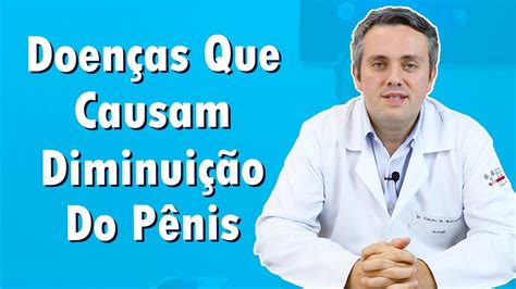 Principais Doenças Que Encurtam O Pênis Dr Claudio Guimarães Youtube