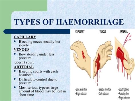 Haemorrhage Original