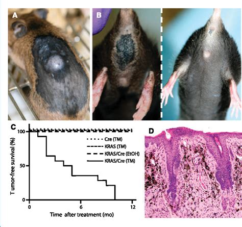 Figure From Tumor And Stem Cell Biology A Mouse Model Of Melanoma