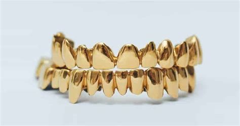 Custom Grillz Las Vegas Nevada Dentistry And Braces