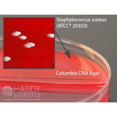 Hardy Diagnostic J62 Dry Culture Media Cnamacconkey Agar Biplate 80