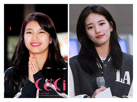 Miss As Suzy Weight Loss Before And After Before After