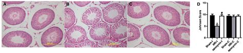 Antioxidants Free Full Text Nadph Oxidase Mediated Testicular