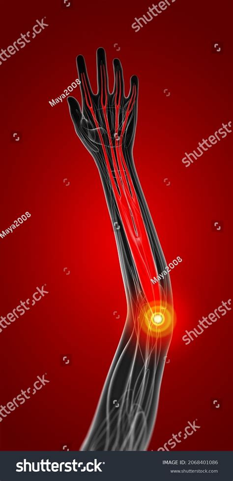 D Rendering Medical Illustration Flexor Digitorum Stock Illustration