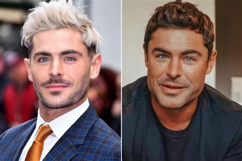 Zac Efron Chirurgie Esthetique Visage Vrai Ou Faux