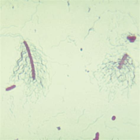 Bacterial Flagella Slide Peritrichous Wm