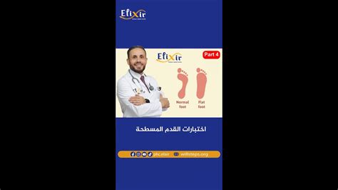 علاج طبيعي علاج فيزيائي د أمين خطيب اوغلو اختبارات القدم المسطحة