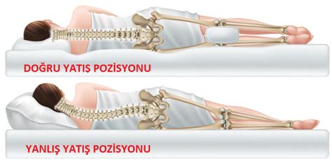 Sırt Ağrısına İyi Gelen Uyku Pozisyonları En İyi Yatak Markaları