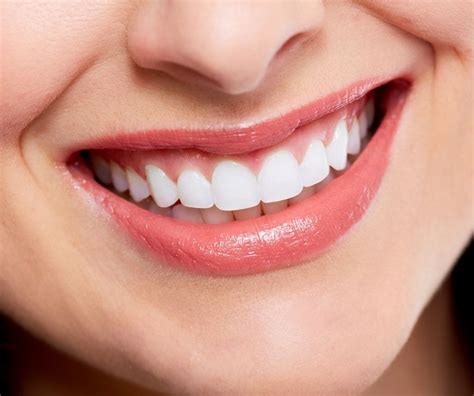 Smile Makeover in Melbourne | Melbourne Dental Family Care