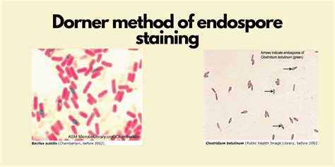 Dorner method of endospore staining: procedure, principle